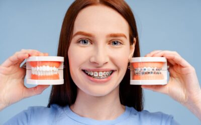 Dental Insurance for Braces